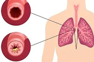 Варианты диагностики органов грудной клетки